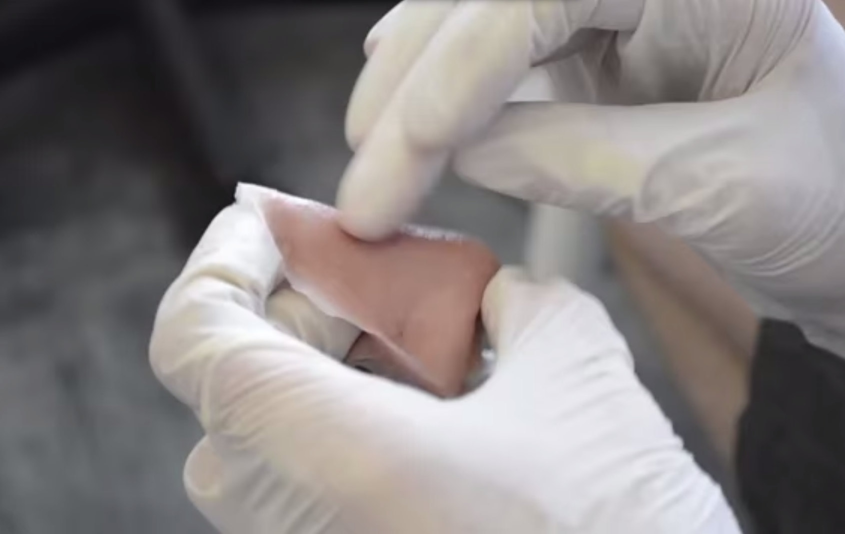 3D Printed Facial Prosthesis Finalist for James Dyson Award